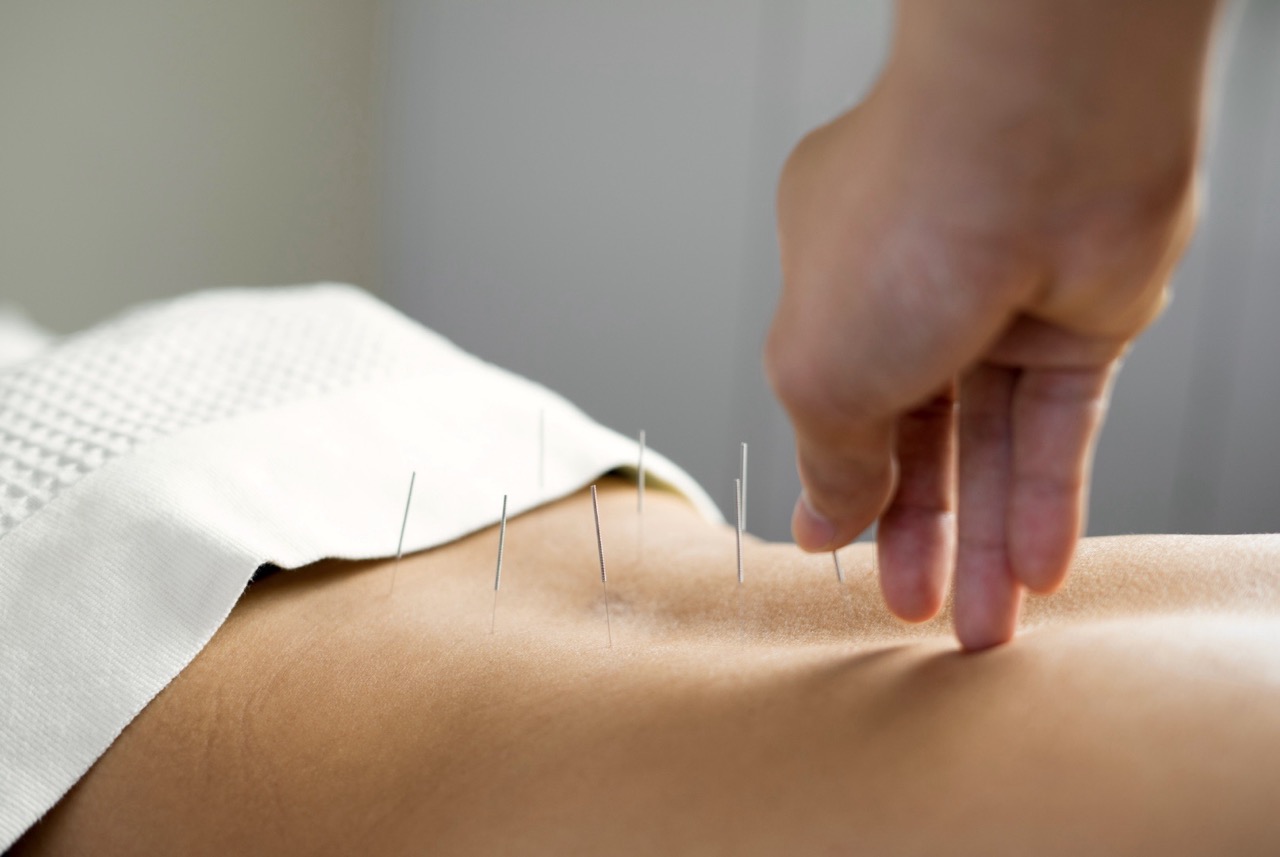 ЛЕКЦІЯ "Метод Dry Needling — «сухої» голки"
